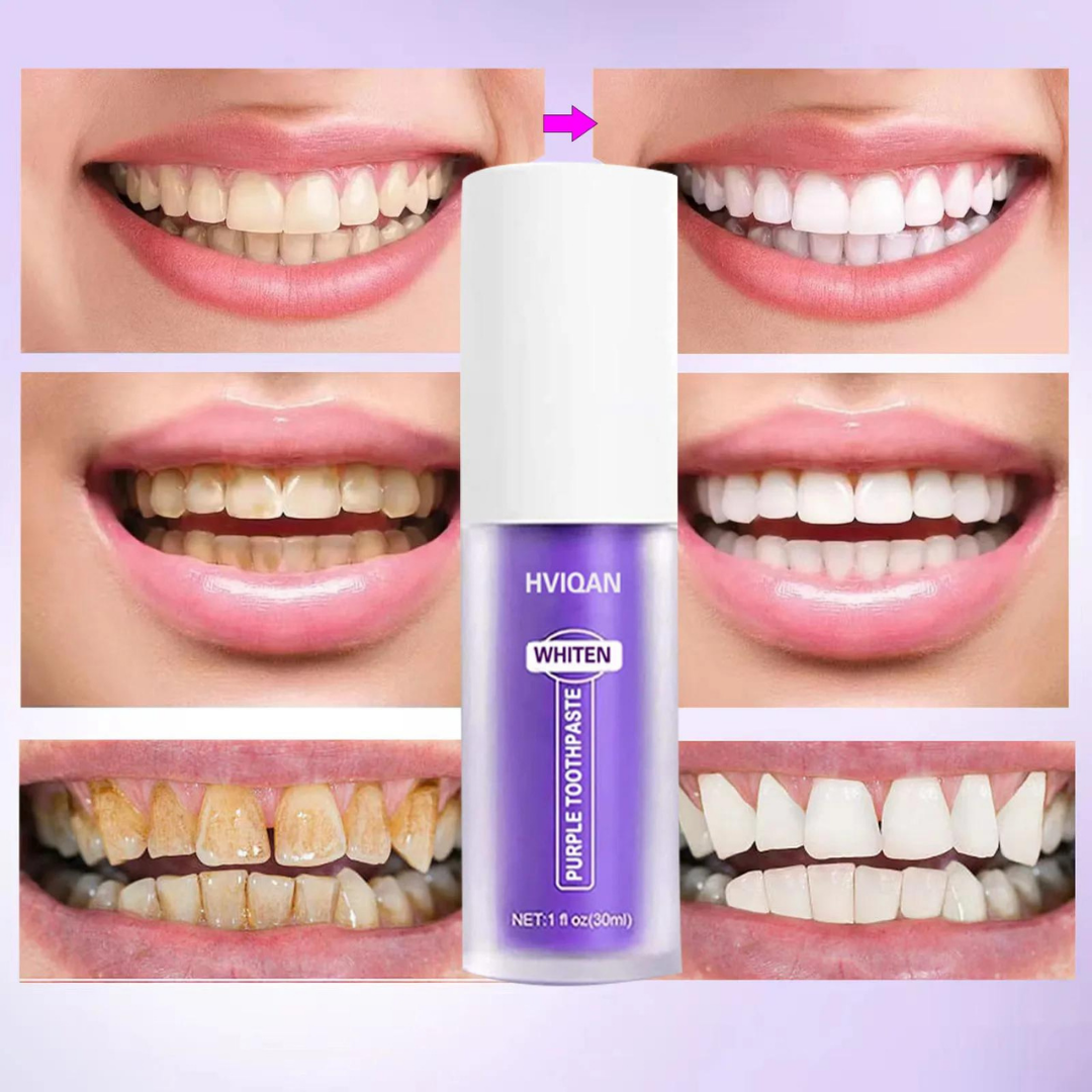 CREMA DENTAL BLANQUEADORA